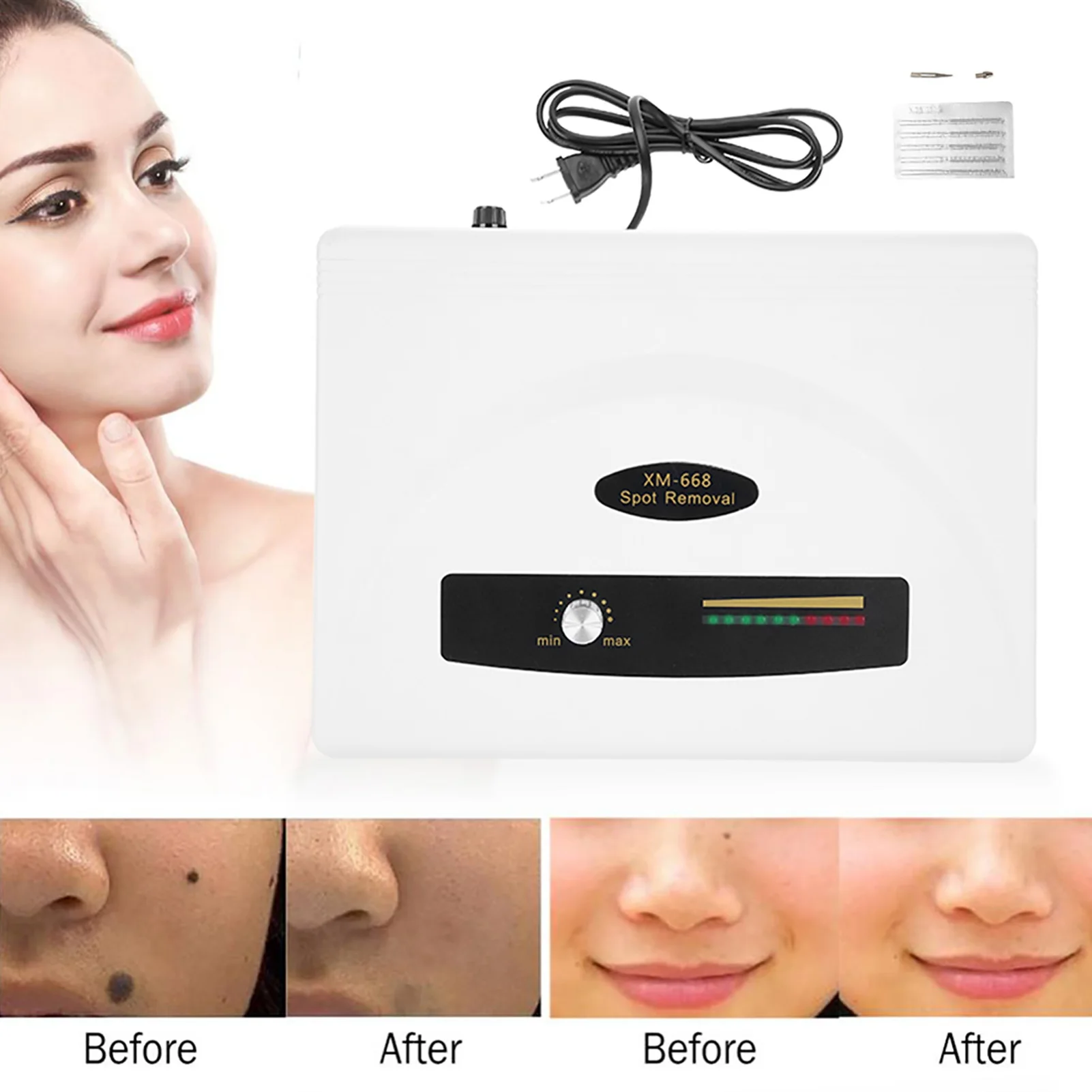 Freckle Remover Mole Removal Pen 10 Gears Ultrasonic Spot Removal Pen Large Power Freckle Mole Removing Home Spa Machine