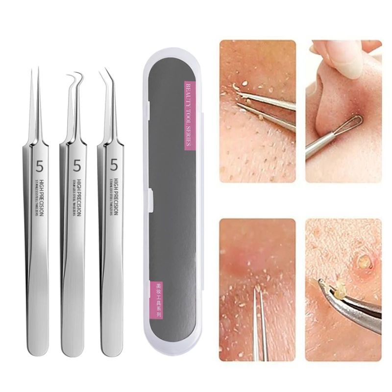 Ultra Fine Blackhead Extractor Tweezer Beard tweezer Acne Remover Needle Single Piece Or Kit Set Facial Skin Care Cleansing Tool