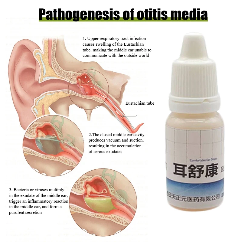 Herbal Antibacterial Ear Drops Treat Ear Canal Inflammation And Tinnitus Cleansing And Antibacterial Protection Of Ear Health