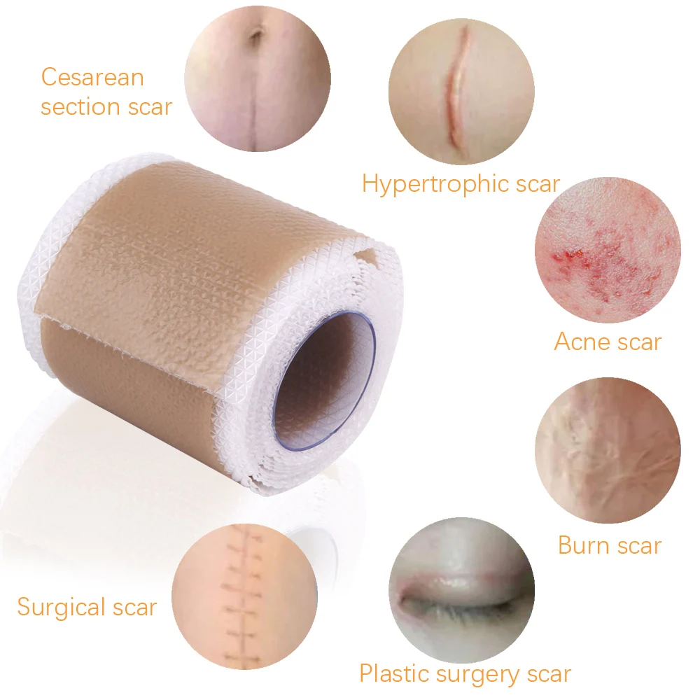 4x50cm Silicone Scars Patch Wounds Band Remove Acne Burn Scar Treatment Cover Ear Correctors Efficient Repair Damaged Skin Sheet