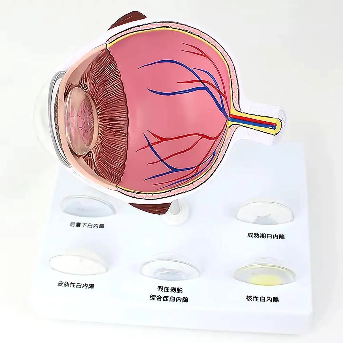 Human Cataract Magnification Eye Internal Anatomy Model Medical School