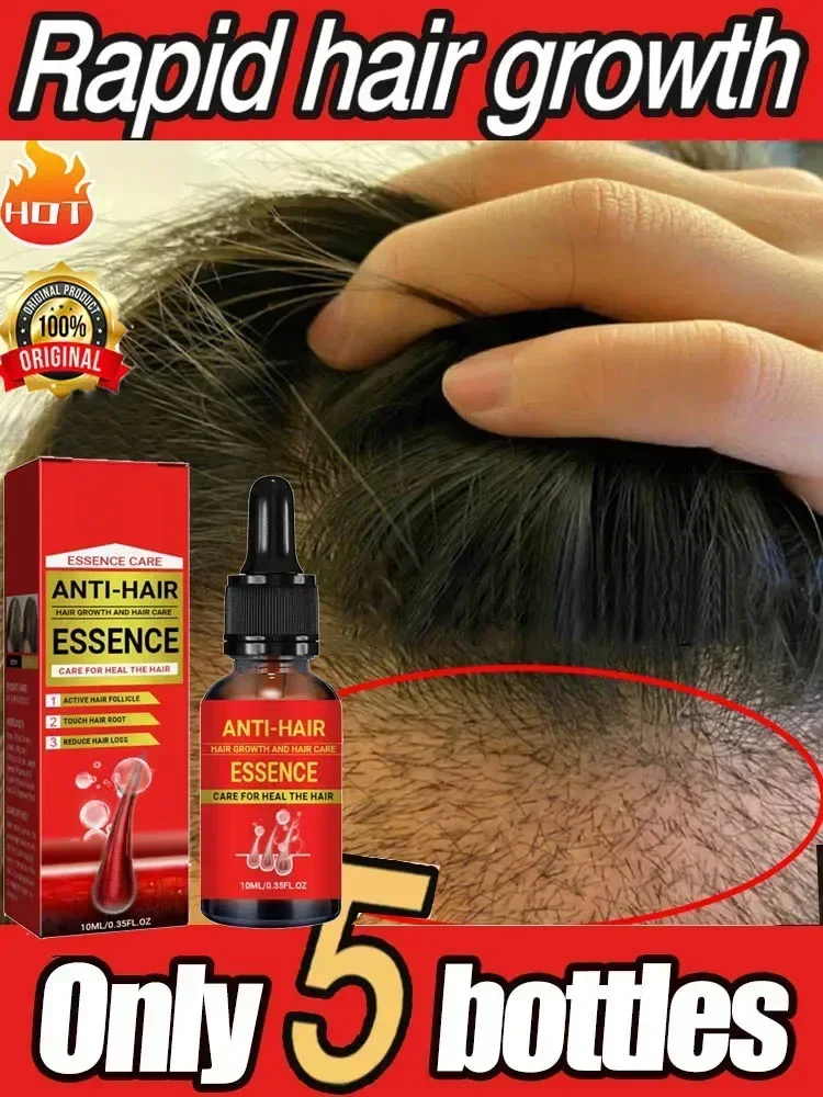 

Nurturing hair Reducing hair-loss and breakage Products Essential Oils Anti Hair Loss Scalp Treatment Hairs Care for Men Women