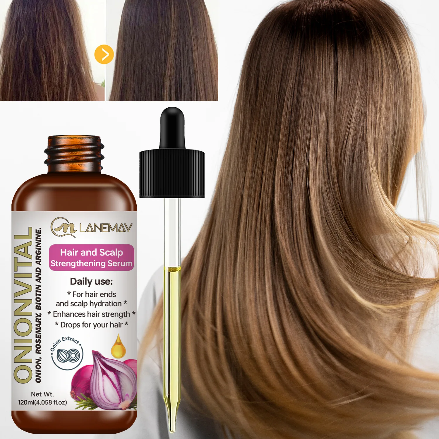 

Onion, Rosemary & Biotin Hair Strengthening Serum – Hydrating Drops for All Hair .
