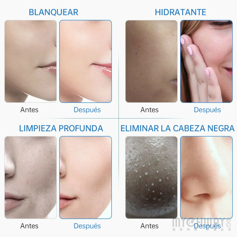 Máquina de hidro dermoabrasão 6 em 1, lifting facial, limpeza profunda, peeling aquático, rejuvenescimento da pele, cuidados com a pele, dispositivo spa