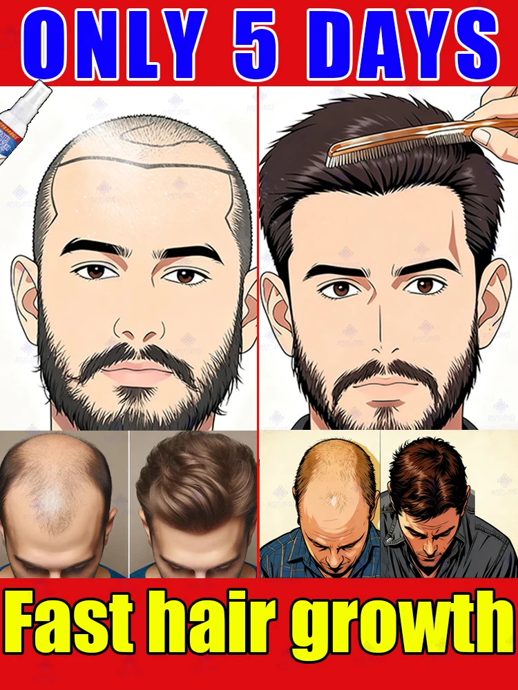 

Hair Growth Essential Loss Regrowth Treatment Strengthens Hair Nourishes Scalp Light Weight Non Greasy Improve Scalp Circulation