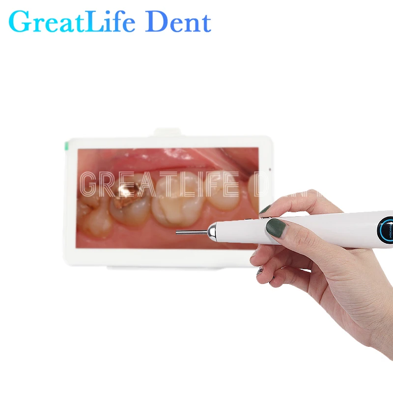 GreatLife Dent Integrated 7-inch Display With 3.9mm Viewable Dental Intraoral Camera Dental Camera Intraoral Camera Intra Oral