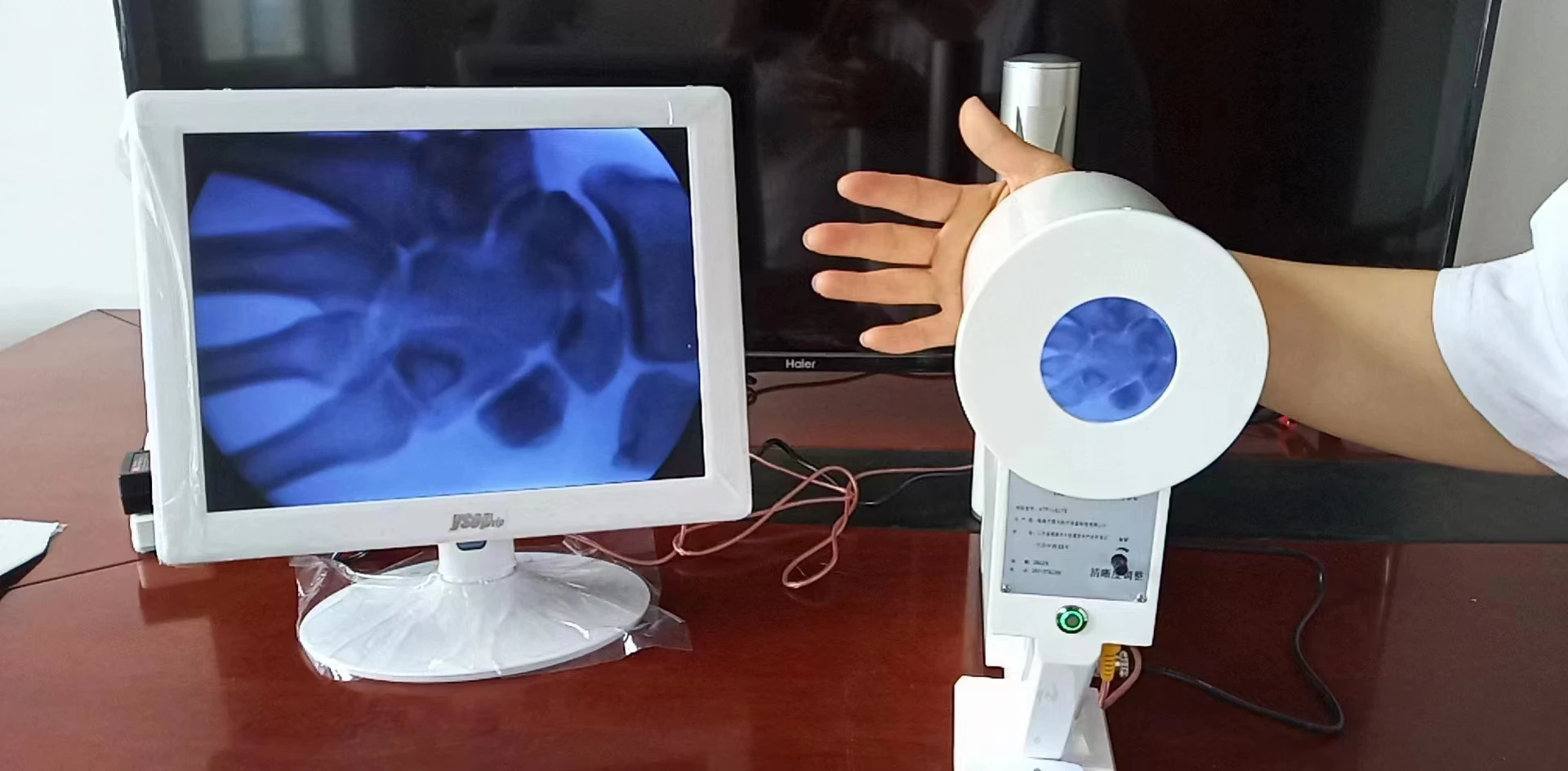 Máquina De Raio X Portátil Médica, Equipamento De Alta Freqüência, Alta Segurança