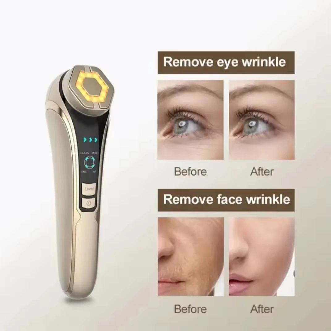 Handheld RF Huidverstrakking Apparaat Anti-Rimpel Gezichtslifting Oogmassage Oplaadbaar Schoonheidshulpmiddel voor thuisgebruik voor verjonging