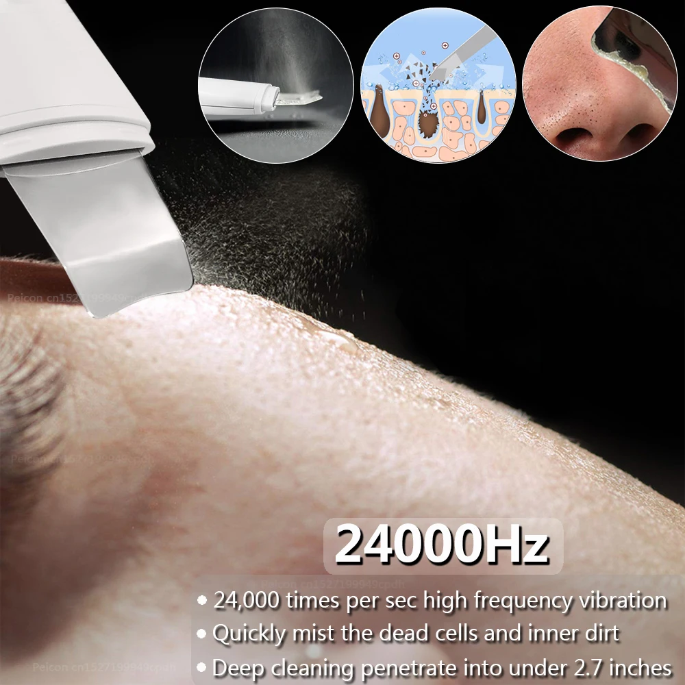 Ultrasonic Skin Scrubber Peeling Blackhead Remover Ion Acne Pore Cleaner Deep Face Cleaning Ultrasonic Facial Shovel Scrubber