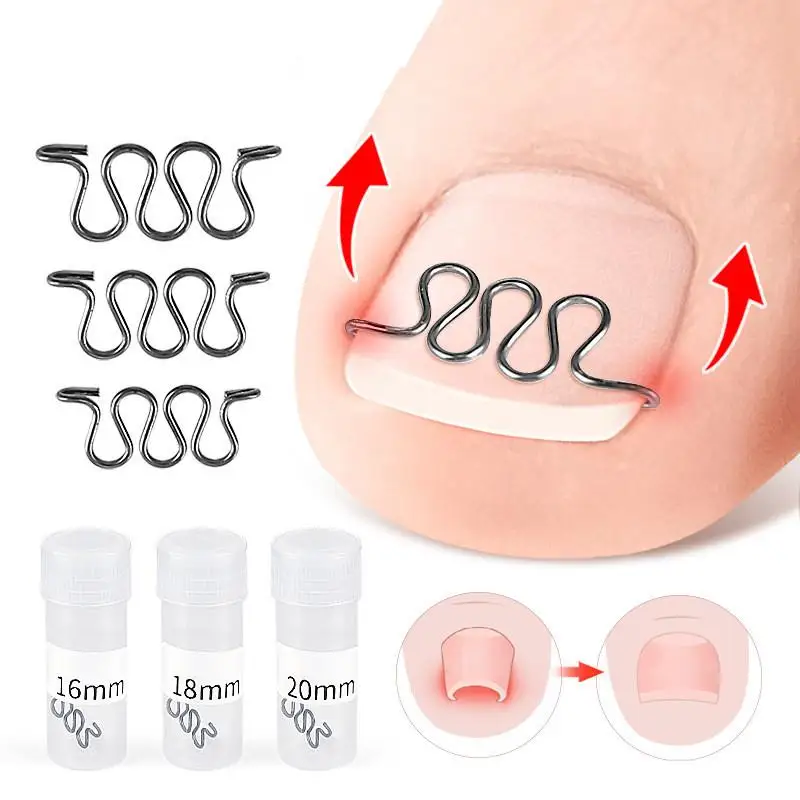 1 Pcs Ingrown Toenail Correction Tool Ingrown Toenail Treatments Elastic Patch Sticker Toenail Straightening Pedicure Tools