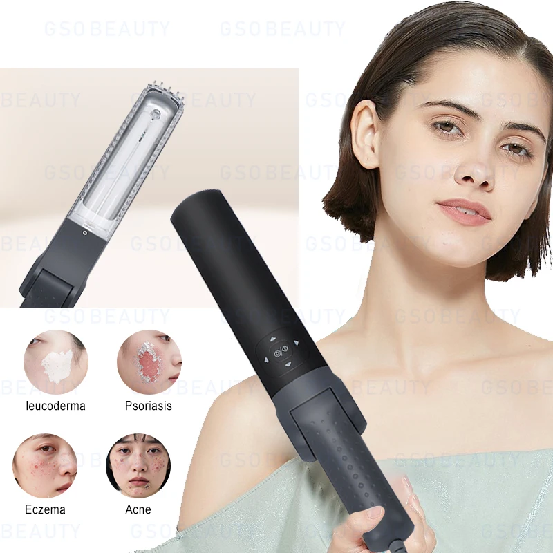 

UVB 308nm phototherapy CE lamp tube, suitable for psoriasis, vitiligo, atopic dermatitis, whiteboard syndrome and eczema treatme