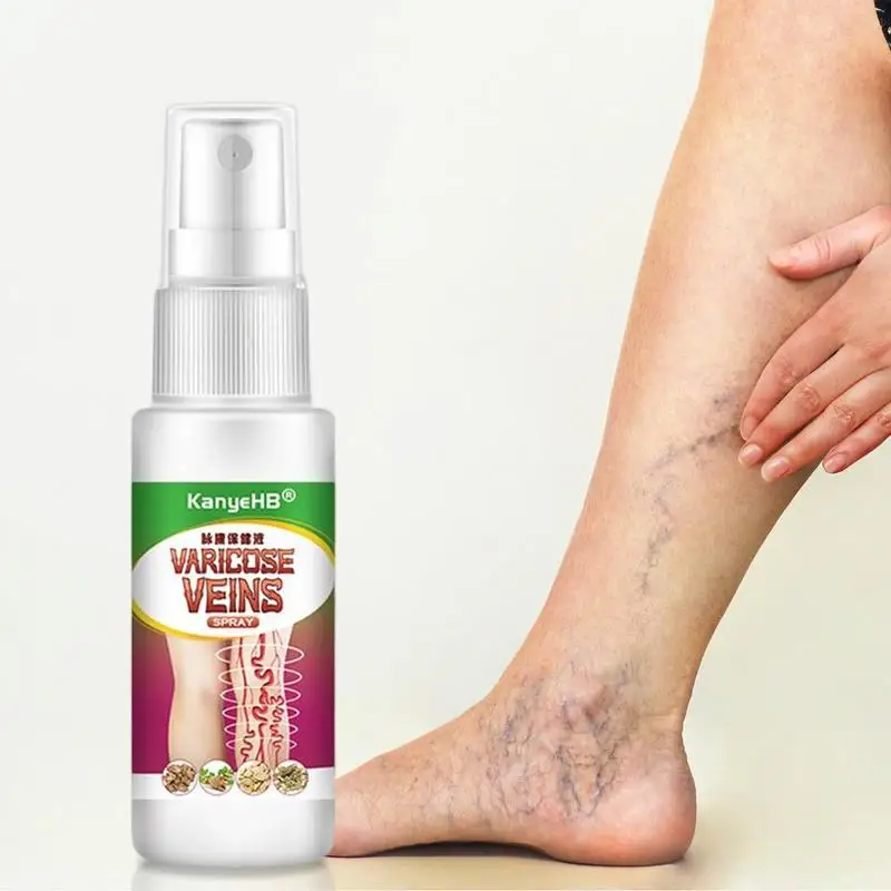 Herbal Varicose Vein Spray 30ml Varicose Vein Care Spray Relieves Phlebitis & Angiitis Inflammation Blood Veins Spider Veins