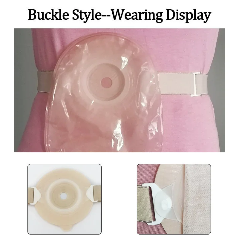 Buckle Style Ostomy Bag Fixation Ring Reinforced Colostomy Bag Stoma Bag Reinforcement Support Ring