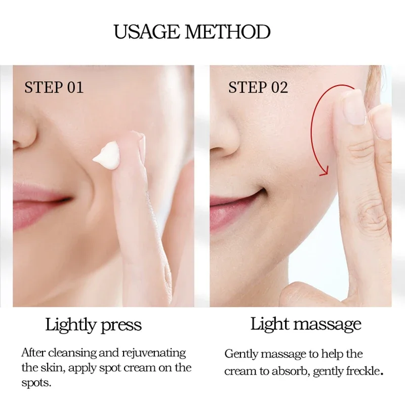 Face Dark Spots Remover for Women Remove Melasma Freckles Cream Removal Melanin Whitening Cream Fade Spots Skin Brightening Care