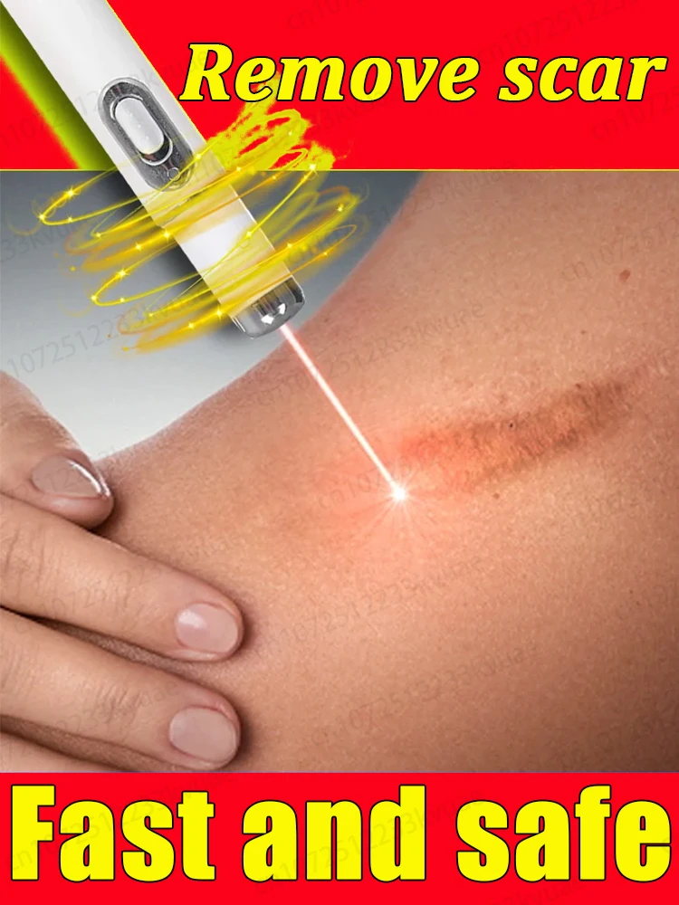 

Magical scar removal product, remove all scars in 7 days