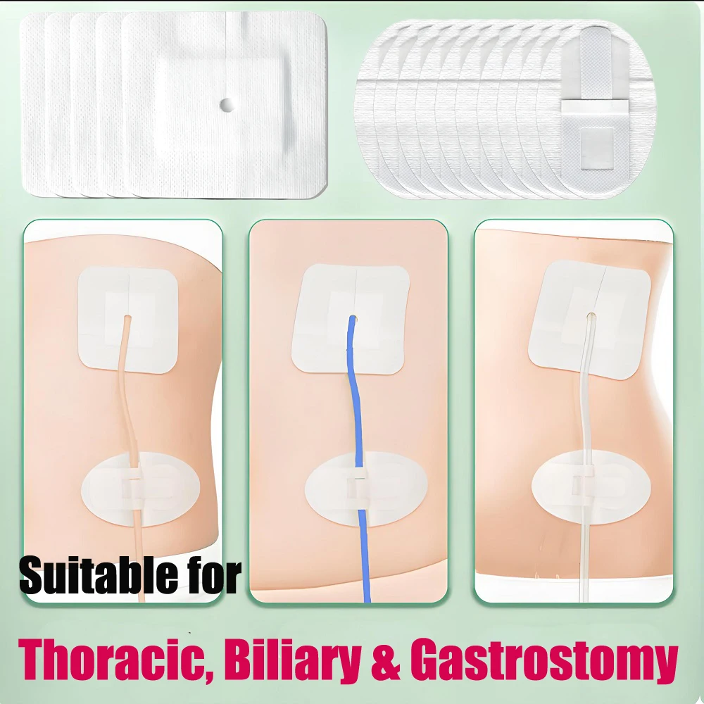 

5-100 шт. дренажная трубка, стерильный аппликатор, фиксирующий пластырь для катетера для дренажа/бинарного/звоночного биопсии, клейкий пластырь