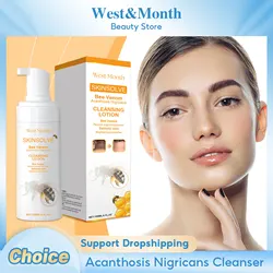 Whitening Facial Cleanser Bee Venom Dark Spot Freckle Removing Deep Cleansing Lightening Skin Tone Moisturizing Face Wash Foam