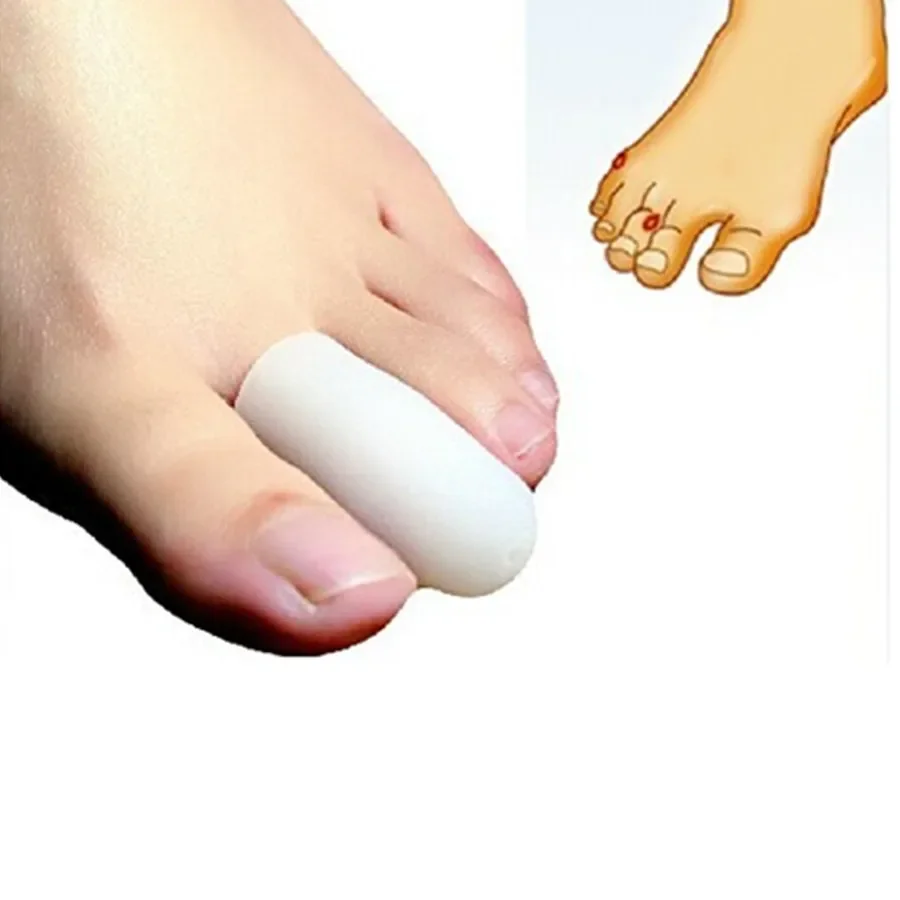 Pedicure Foot Feet Toe Finger Care Sets Thumbscrews Heloma Care Corns Calluses Pain Relief Cure Protector  Straightener Toe