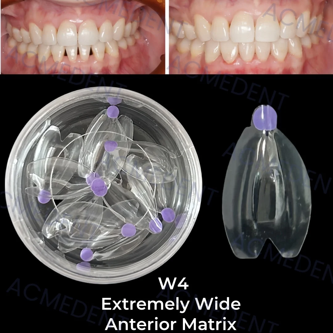 W4 Dental Anterior Wide Matrix Transparent Clear Matrix BT Bow Maxillary Matrices Contoured Fit BioClear Matrice Black Triangle