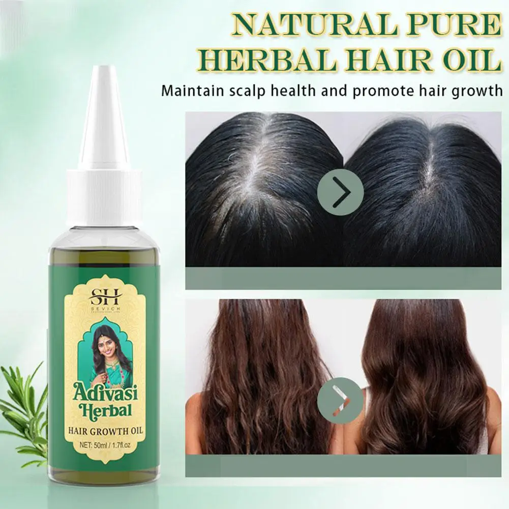 Minyak Herbal pencegah kerontokan rambut rontok reair halus perawatan pemeliharaan halus rusak halus perawatan rambut kering kulit kepala rambut Z6M3