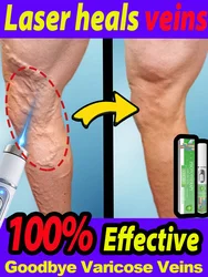 Laser vein Medical level