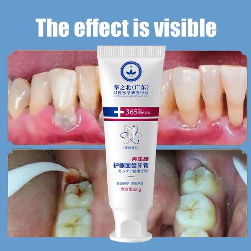 New Upgrade Quick Repair of Cavities Caries Removal of Plaque Stains Decay Whitening Yellowing Repair Teeth Teeth Whitening