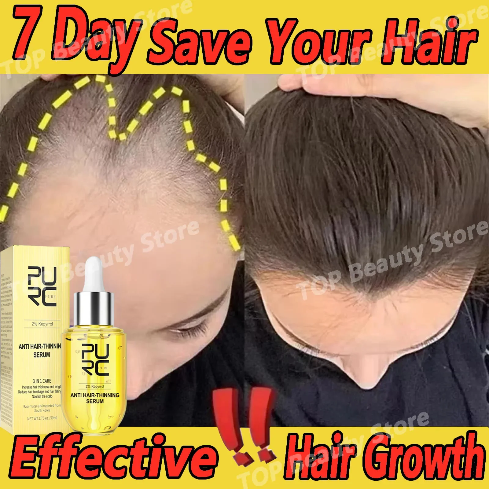 

Hair Growth Essence 7day Rapid Regeneration Essence Anti Alopecia Baldness Repair Scalp Injury Male Female Nursing Hair Care