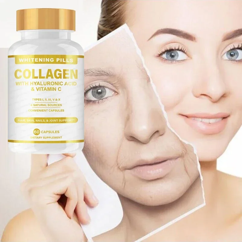 Skin whitening collagen pills, vitamin C whitening anti-wrinkle prevention hair, skin and nails combined support