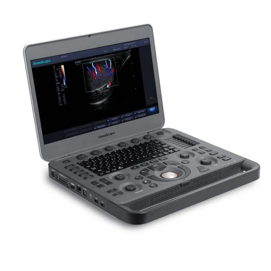 5d Ultrasound Machine SonoScape X5  Portable Ultrasound Doppler Scanner