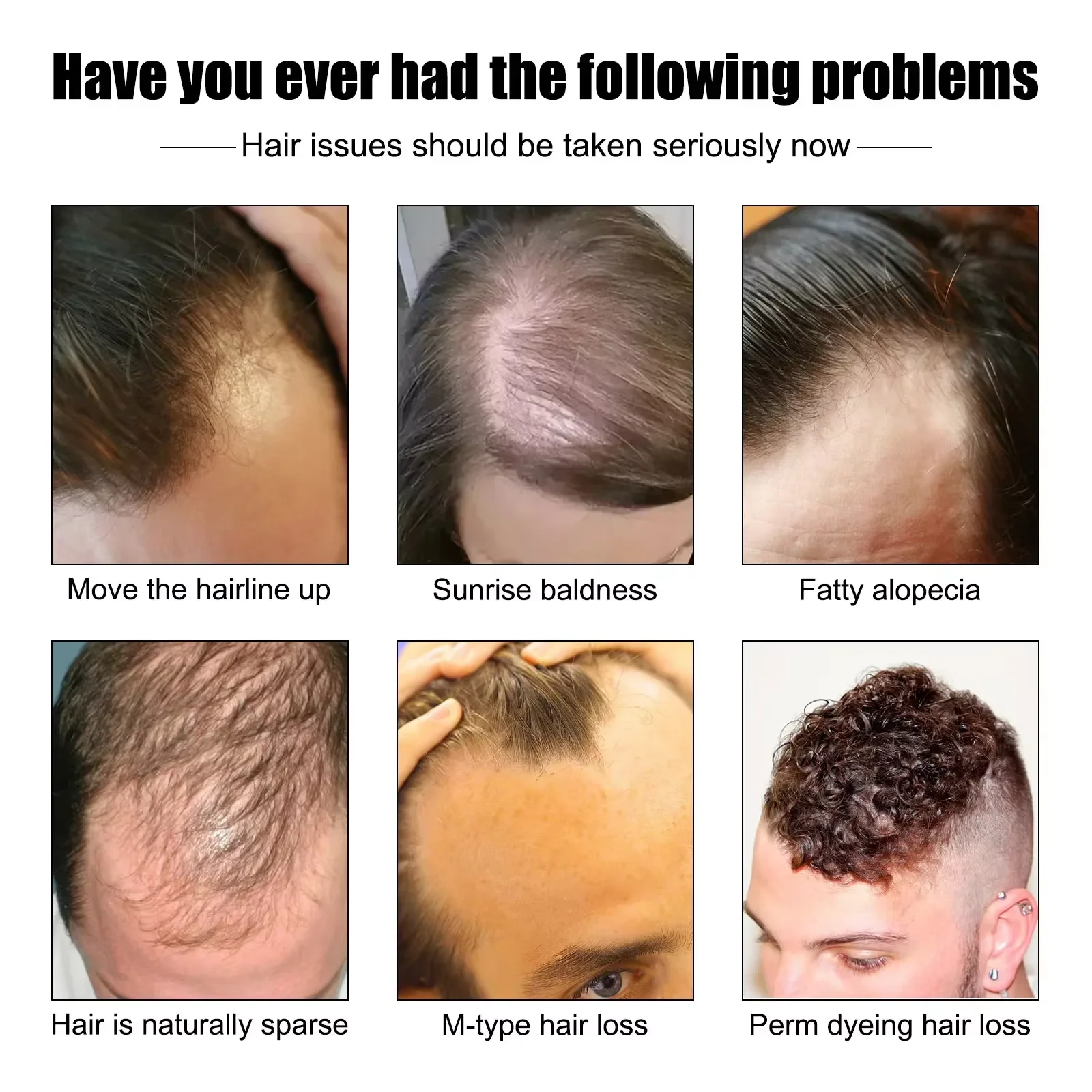 

Сыворотка для роста волос для мужчин, против выпадения волос, восстановление повреждений, масло для восстановления истончения кожи головы, питательная эссенция для ухода за волосами