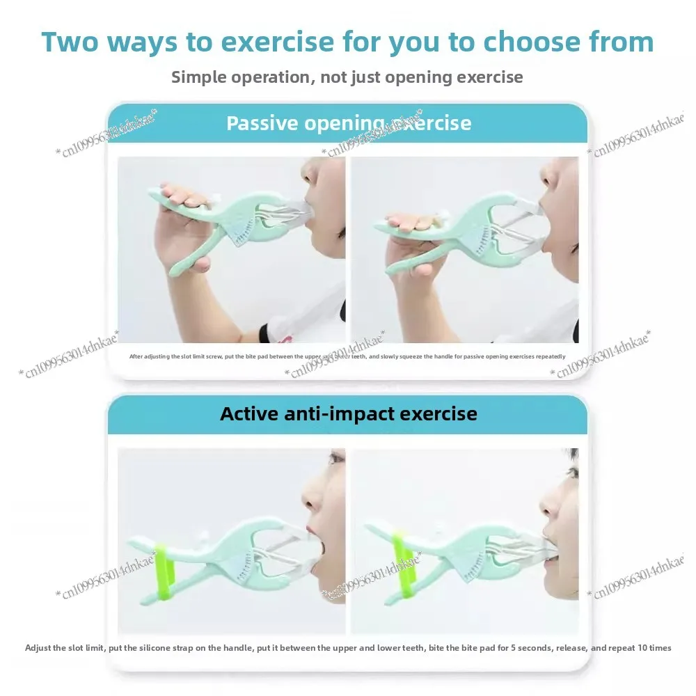 Mouth Opening Trainer Opening Mouth Expander Postoperative Oral Mouth Opening Mandibular Rehabilitation Exercise