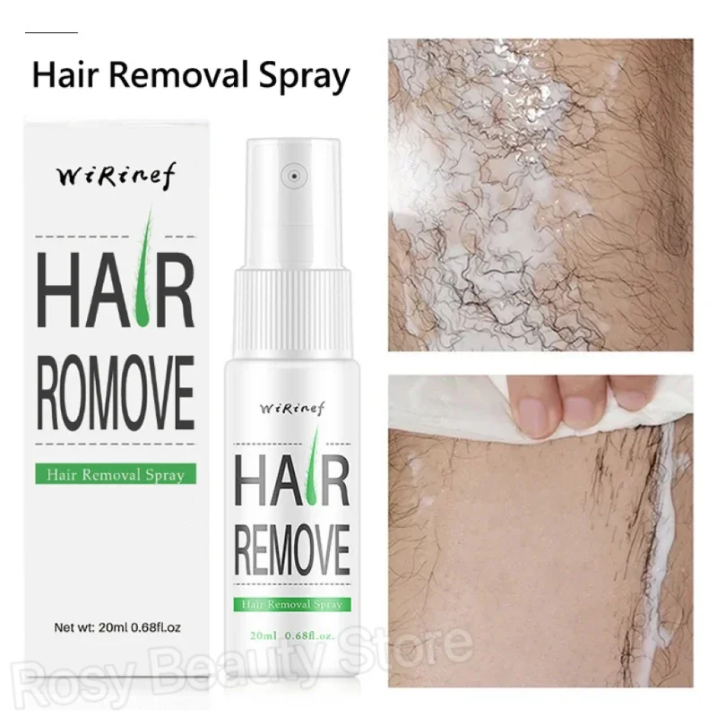 Fast Hair Removal Spray Painless Hair Growth Inhibitor Remove Armpit Leg Arm Permanent Depilatory for Men Women Repair Body Care