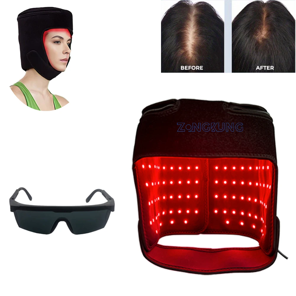 

180LEDs Red Light Treatment Cap Head Relaxation Care Massage 650nm Lamp Treatment Laser Anti Hair Loss Cap Helps Hair Growth