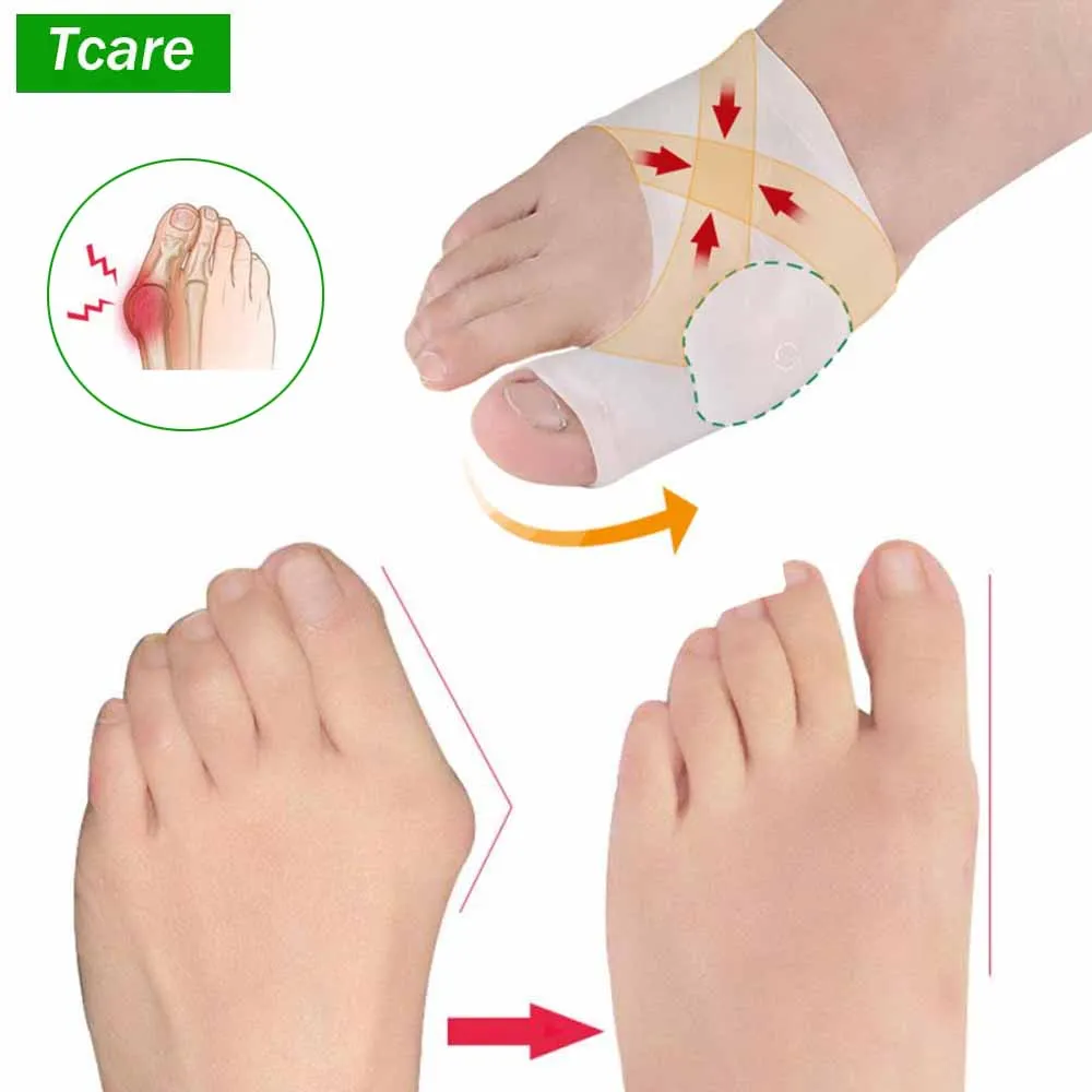 Tcare 1Pair New Gel Orthopedic Bunion Corrector Sleeves - Foot Bunion Protector- Hallux Valgus Original Big Toe Bunion Corrector