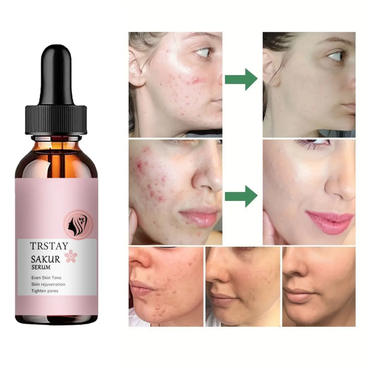 

TRSTAY Sodium hyaluronate, VC nicotinamide, cherry blossom essence, brighten skin tone, improve skin problems, moisturizing esse