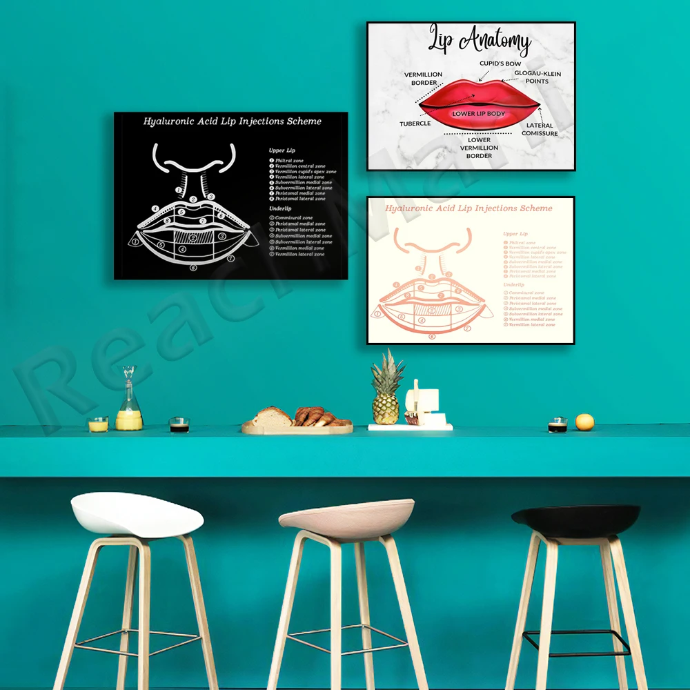 Hyaluronic acid lip injection protocol, red lips anatomy picture, lip anatomy, plastic surgeon gift, beauty therapy poster