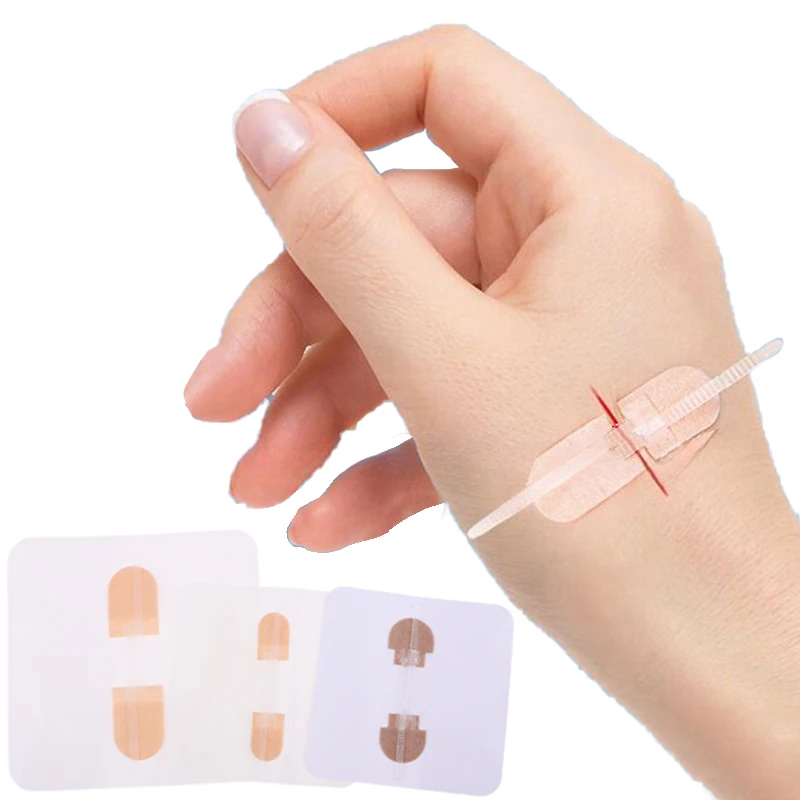 1Pcs Fast Suture Zipper Band-Aid Zipper Tie Wound Closure Patch Hemostatic Patch Wound Outdoor Portable