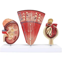 Educational Model Human Organ Anatomical Model Kidney Template with Urinary Glomerular Medical Model For Medical Education