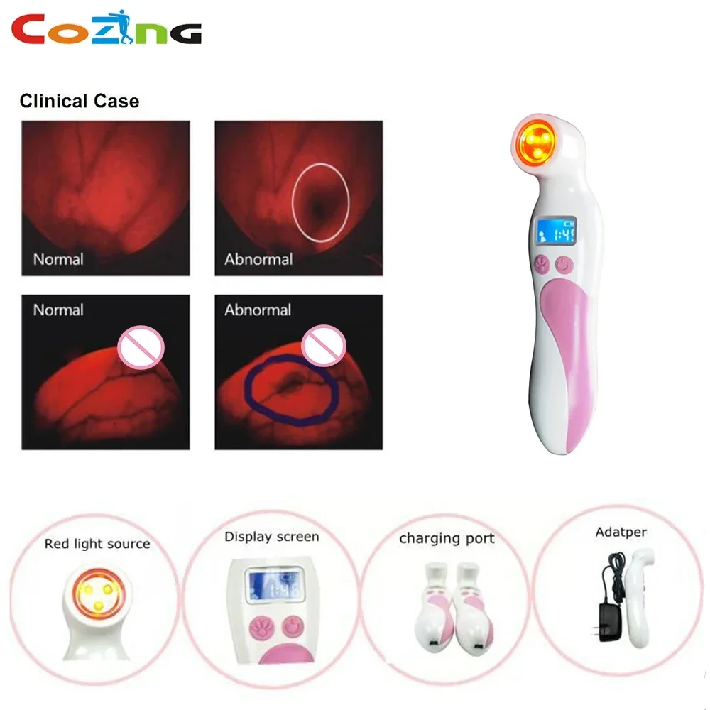 The New Arrival Female Breast Fibroids  Breast Inspection Breast Self Examination Infrared Diagnostic Machine for Women Use