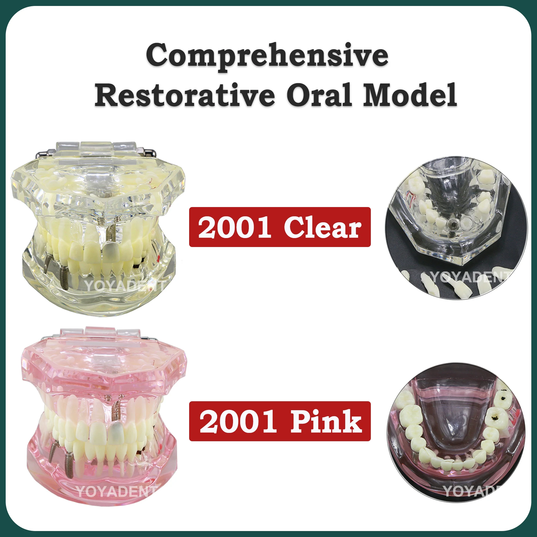 Dental Teeth Repair Model Disease Teeth Model for Dentist Student Practice Training Studying Oral Medical Dentistry Tools