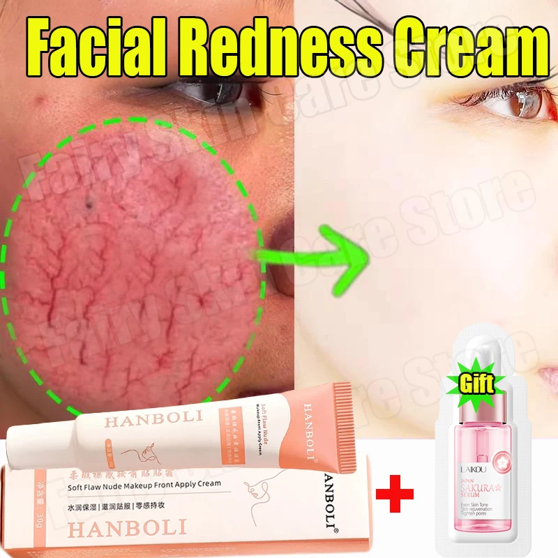 Facial Redness Repair Cream Improve Sensitive Skin Dryness Moisturizer Hydrating Sooth Lotion Removal Rosacea Korean Cosmetics