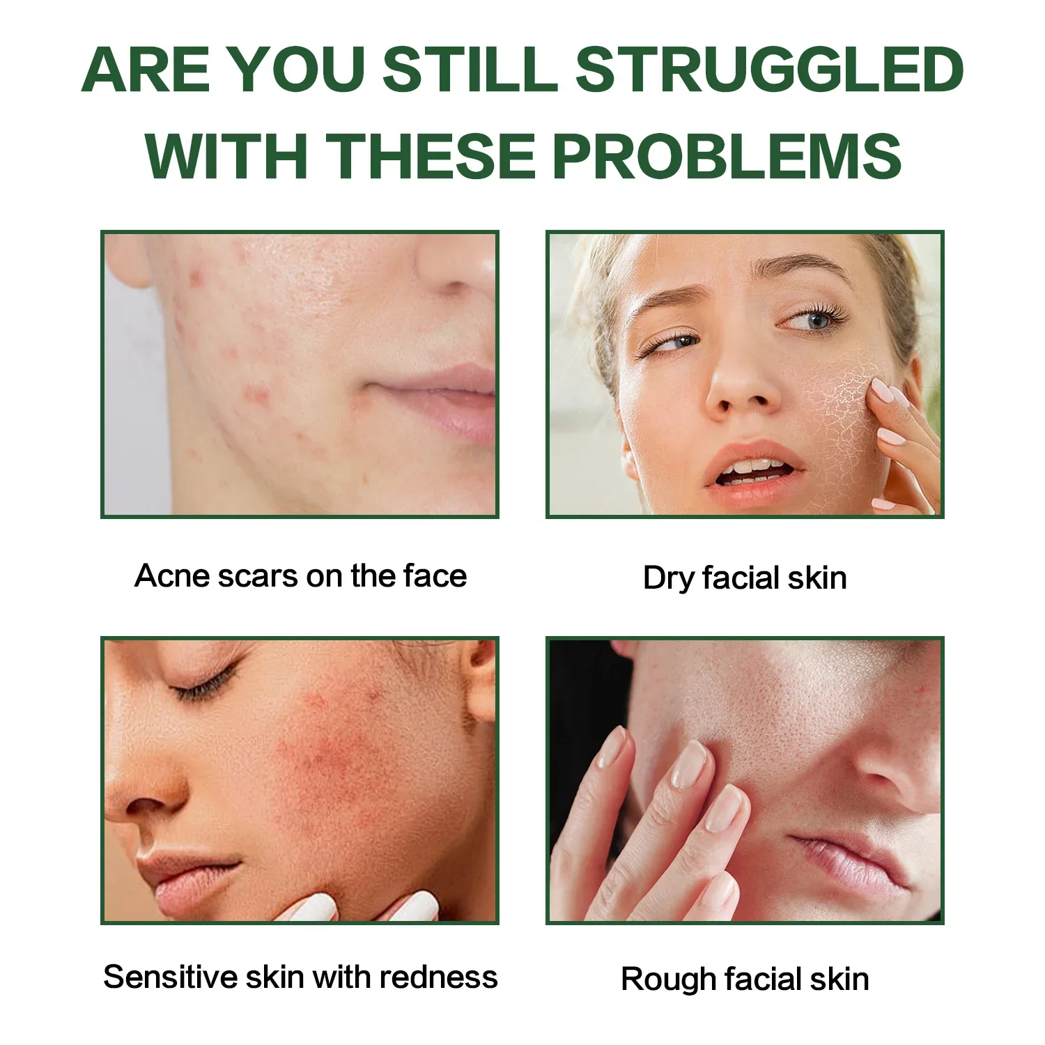 ترطيب الألوة فيرا جل غسل الحرة المغذي العميق الحفاظ على الجلد الألوة فيرا اللثة منعش غير لزجة العناية بالوجه كريم وجه