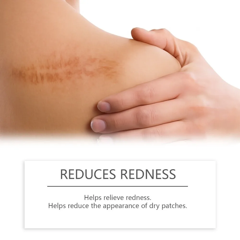 Palo ligero para tratamiento de cicatrices, fórmula suave, fácil de aplicar, palo de cicatriz de silicona, palitos de silicona hipoalergénicos para uso diario