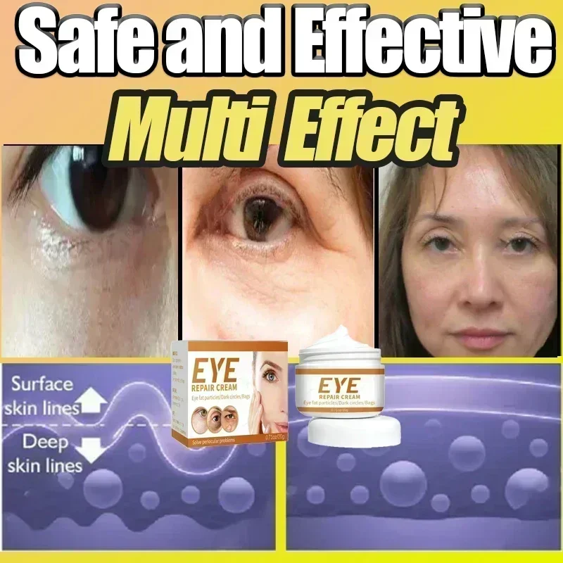 02 إزالة التجاعيد كريم عين أكياس العين الهالات السوداء مكافحة الانتفاخ شركة كريم تحت العينين تفتيح الخطوط الدقيقة ترطيب #6