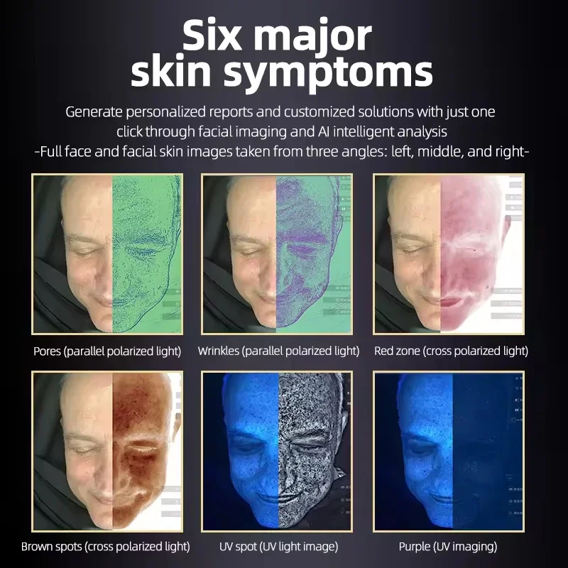 Analizator skóry 3D BV AI Technologia analizy twarzy 3D Wykrywanie problemów skóry - analiza wilgotności Profesjonalne urządzenie do salonu piękności