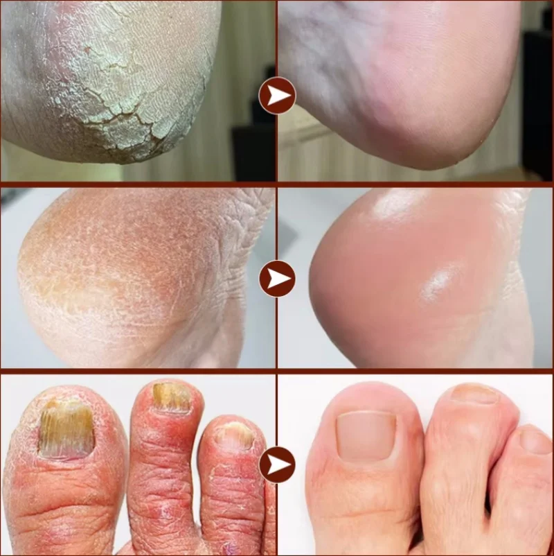 Anti Crack Foot Cream Heel Cracked Repair Horse Oil Cream Smooth Removal Dead Skin Callus Anti-Drying Hand Feet Skin Care 30g