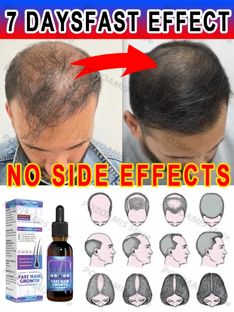 

99% repurchase, more and more hair, say goodbye to baldness, hot selling product