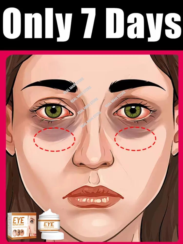 

6Eye cream to eliminate dark circles and eye bags, nourishing the skin around the eyes to make you look younger.