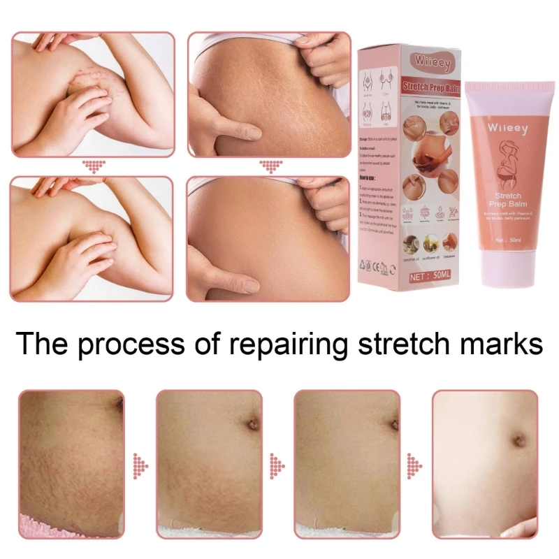 Remove Pregnancy Scars Skin Body Cream Postpartum Stretch Marks Repair Cream P31B