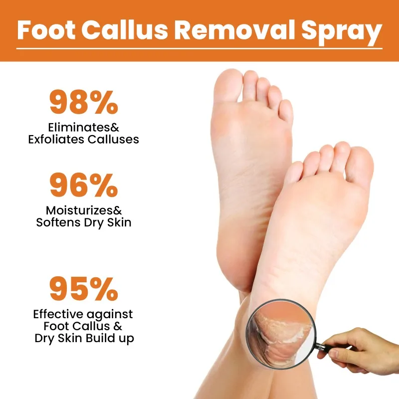 Foot Callus Removal Spray Orange Essential Oil Exfoliating Nourish Peel Feet Calluses Dead Skin Remover Pedicure Foot Care Tool